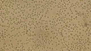 Microscopic Observation of Yeast Cells and Budding in Candida Species [upl. by Carolyne]