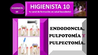 ENDODONCIA DIFERENCIA ENTRE PULPOTOMÍA Y PULPECTOMÍA TEMARIO GENERAL 24 [upl. by Barabas]