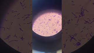 Gram positive sporeforming bacilli shorts microscope [upl. by Risan495]