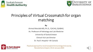 Principles of Virtual Crossmatch for solid Organ Matching [upl. by Aldercy]