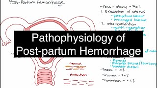 Pathophysiology of Postpartum Hemorrhage [upl. by Sydelle180]