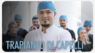 Trapianto di capelli prima e dopo [upl. by Oigolue159]