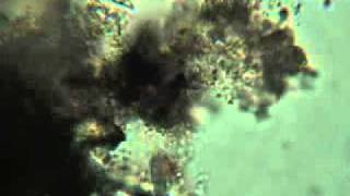 Fish Tank Filter Organisms Under a Microscopeflv [upl. by Lucky]