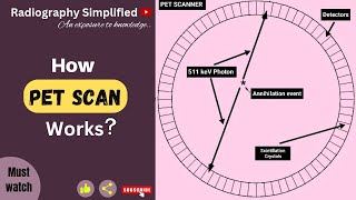 How does PET scan works ll positron emission tomography ll radiography simplified [upl. by Rutter]