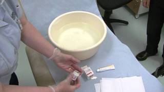 Hand eczena using potassium permanganate soaks [upl. by Gail]