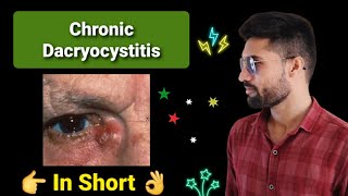 Chronic Dacryocystitis lecture opthalmology in short [upl. by Kaitlynn]