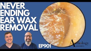 NEVERENDING EAR WAX REMOVAL  EP901 [upl. by Llerrom]