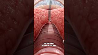 Bronchoscopy 3D Animation [upl. by Rabassa275]