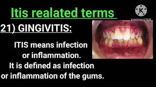 ITIS Related Terms Competativeexam GNM SINUSITIS GINGIVITIS MYOCARDITIS  The way of learning [upl. by Ahsilet]