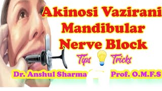 AKINOSI VAZIRANITECHNIQUELANDMARKSCLOSED MOUTHMANDIBULAR NERVE BLOCKCOMPLICATIONSMALAMED [upl. by Suhpoelc920]