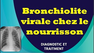 Bronchiolite virale chez le nourrisson [upl. by Lougheed612]