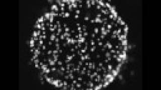 73 Development of Cellular Slime Molds Dictyostelium discoideum D Purpureum amp D Minutum [upl. by Tyson]