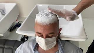 Saç Ekimi Sonrası İlk Yıkama ve Losyon Sürme First Washing and Lotion Apply After Hair Transplant [upl. by Latham]