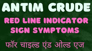 Antimonium Crudum Redline Indicator 🌺 Homeopathic Medicine 🌺 [upl. by Branca467]