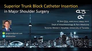 Superior Trunk Block Catheter Insertion  Quick and Easy [upl. by Garrik]