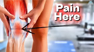 The BEST Rehab Exercises For Patella Tendinopathy [upl. by Erej]