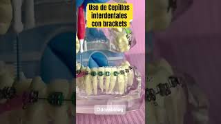 Cepillos interdentales con brackets shorts brackets bracket cepillosinterdentales ortodoncia [upl. by Nauqyt]