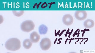 Malaria Lifecycle Part 1 Human Host 2016 [upl. by Asiat787]