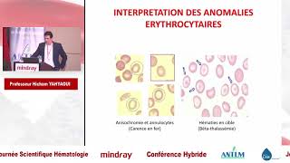 Interprétation d’Hémogramme dans un Laboratoire d’Hématologie [upl. by Wilser]