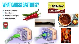 Chronic Gastritis Causes Symptoms Treatment Prevention Why treatment fails and How to fix it [upl. by Ainosal135]