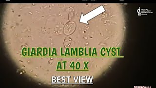 Giardia Lamblia cyst view at 40 XBest microscopic view of giardia cystgiardia parasite in stool [upl. by Tersina]