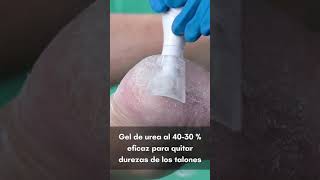 ¿Tu Pie Necesita Un quotResetquot Prueba el Gel de Urea para Durezas [upl. by Synned8]