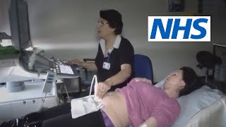 What happens at a scan and what will they tell me  NHS [upl. by Ahsienot]