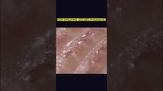 How Sweating Occurs in Humans Human Science Skin Body Health Explore Reels [upl. by Sly]