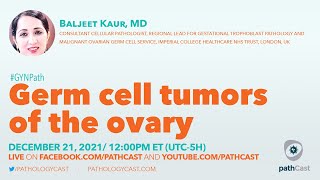 Germ Cell Tumors of the Ovary [upl. by Chamkis841]