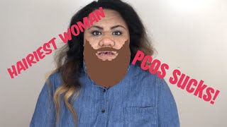 Hairiest Woman Alive Dealing With PCOS [upl. by Atiuqrahs]