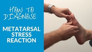 How to diagnose metatarsal stress reaction and fracture [upl. by Enihpets]