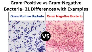 Gram Positive vs Gram Negative Bacteria 31 Differences with Examples [upl. by Nonnarb]