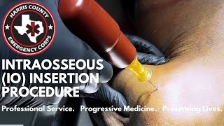 Intraosseous IO Insertion Procedure [upl. by Adnor612]