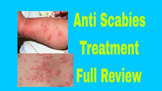 AntiScabies Treatment In Urdu [upl. by Khichabia]