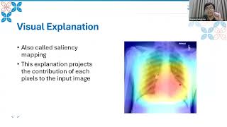 Explainable Artificial Intelligence XAI in deep learningbasedmedical image analysis [upl. by Ury]