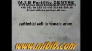 epithelial cells in female urine [upl. by Ahsiloc609]