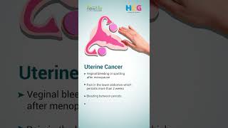 Gynecological Cancer Awareness Month  Dr Nikhil Mehta [upl. by Jegger504]