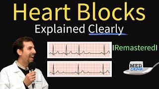 Heart Blocks Explained  First Second Third Degree and Bundle Branch on ECG [upl. by Yvor27]