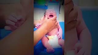 How can we check moro reflex in newborn baby 🍼 cutebaby newbornbaby hospital nicubaby [upl. by Gadmann]