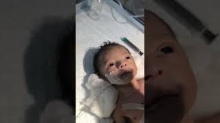 Chestryped for newborn baby😌 sumitnicunursingstm youtubeshorts nursing newbornbaby chestworkout [upl. by Georgia]