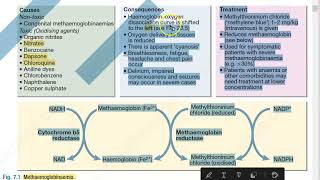 Medicine 157 MetHemoglobinemia [upl. by Nevak734]