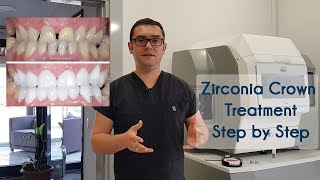 Zirconia Crown Treatment in Turkey amp How We Produce Zirconia Crowns in Elit Dental Clinic Kusadasi [upl. by Geibel]