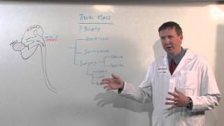 Treatments for Kidney Tumors  Kenneth Nepple MD [upl. by Vada]