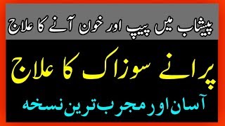 Sozak ka mukammal ilaj  Sozak Treatment By Hakeem Zia Shahid [upl. by Elrebma]