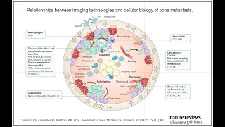 Whole body MRI for Bone Metastases Assessments  2021 [upl. by Yona179]