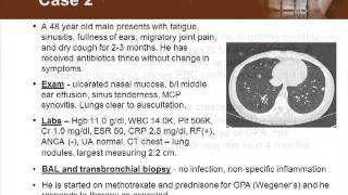 Detecting Vasculitis Before Its Too Late [upl. by Rez807]