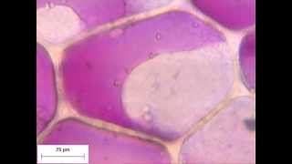 The limit of plamolysis in cells of lower epidermis of quotRhoeo discolorquot [upl. by Matheson]