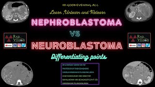 NEPHROBLASTOMA VS NEUROBLASTOMA [upl. by Boatwright]