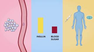 Human clinical trial reveals verapamil as an effective Type 1 diabetes therapy [upl. by Etteval]