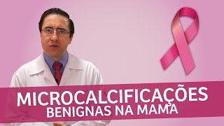 Microcalcificações benignas na mama  IMEB [upl. by Nehte]